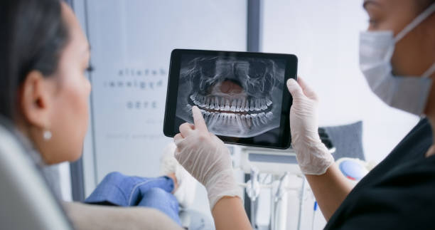Licensed Tooth Extraction service in Cupertino, CA - Smile Center Dentistry